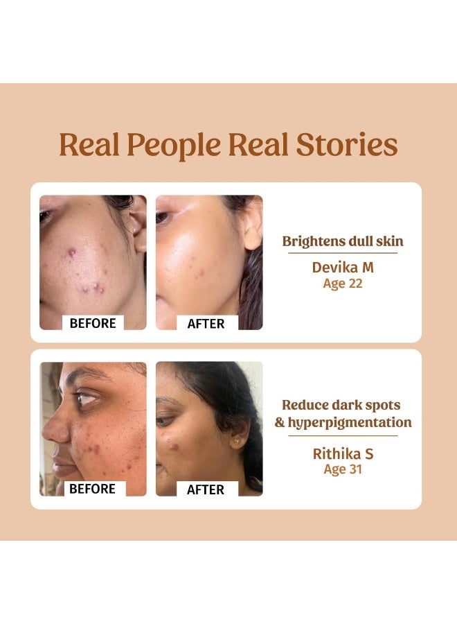 Vilvah Store Milk Drops Brightening Serum Formulated With Rice Milk Extract, Marine Algae Extract, Alpha Arbutin, Fades Scars, Brightens Skin & Even Skin Tone For All Skin Type, 40ml - Image 4